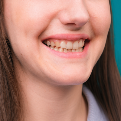 Before - Amy G. 35